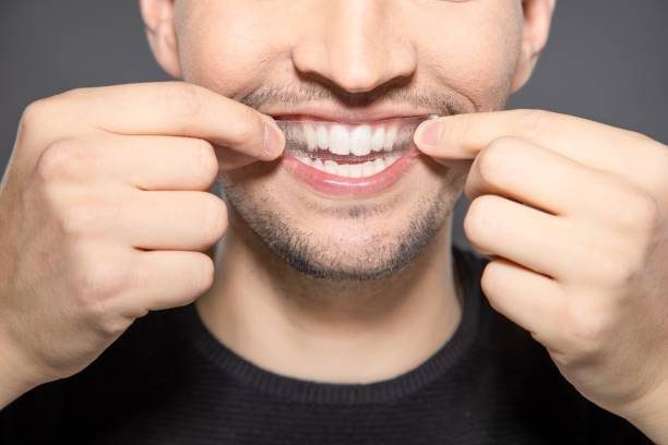 close-up shot of a person's mouth using a teeth whitening strips